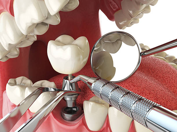 Best Mobile Emergency Dentist in Commerce, CA